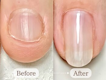 ル リアン 北浦和(le lien)の写真/《深爪卒業プラン¥12000》爪を綺麗な形に整えたい、ピンクの部分を伸ばしたい方というお悩みの方に[北浦和]