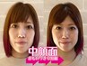 【人中＆中顔面短縮】大好評メニューの中顔面を短縮する美顔デザイン構築術