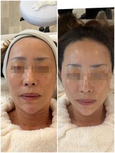 クリスタルグロウ 苫小牧大町店(Crystal Glow)/CURAIMフェイシャル