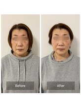 チル(Chill.)/美容整体×小顔整顔でリフトUP！