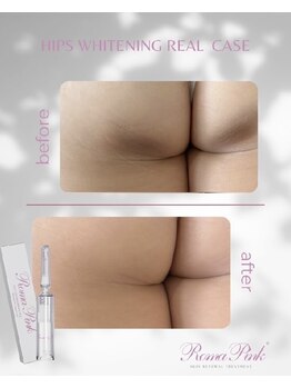 シェリ(Cheri)/ロ-マピンク☆ヒップ