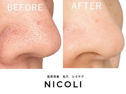 ニコリ(NICOLI)の写真