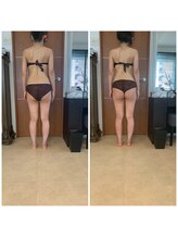 ブランシェ 銀座(blanche)/踵から変えて脚を長く細く