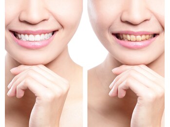 宮崎セルフホワイトニング/もう一度体験してみたいお客様