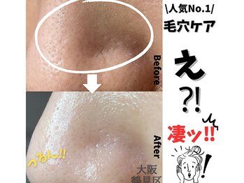 リッカロッカ(RIKKA&ROCCA)/人気No.1毛穴ケアと言えばこれ！