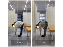 ナオル整体 飯田橋院(NAORU整体)/Before After/飯田橋/整体・矯正