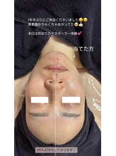 スピカ(Spica)/spicaの小顔フェイシャル