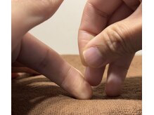 エクステンド鍼灸整体院(extend鍼灸整体院)/触れる鍼 2