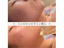 カオヤ プラス(Kaoya plus)/エンビロンビタミン導入◎