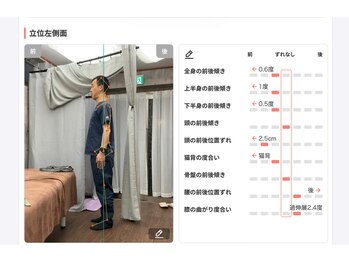 しじみ整体ラボ/3回目施術後の院長先生、横向き