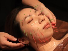 和香の雰囲気（☆当店イチオシ☆国家資格者による美容鍼【小顔効果×美肌効果】）