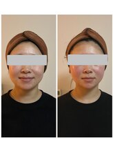 クー(9 Kuu)/小顔◇フォースカッター初回効果