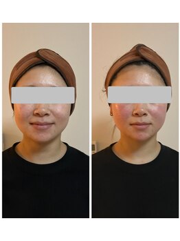 クー(9 Kuu)/小顔◇フォースカッター初回効果