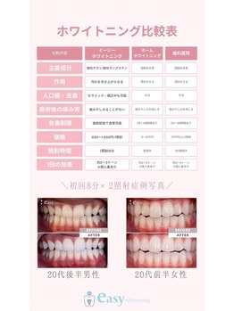 イージーホワイトニング 神戸三宮店(easy whitening)/ホワイトニングの違い◎