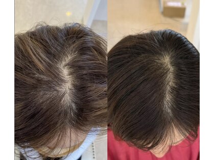 カナエル ビューティーサロン(Canael Beauty salon)の写真