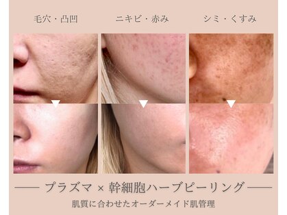 ラクシュミー(laksmi)の写真