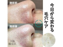 リッカロッカ(RIKKA&ROCCA)/今日から変わる毛穴ケア