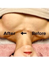 すなお 溝の口(Sunao)/【バストアップ】30代後半お客様