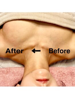 すなお 溝の口(Sunao)/【バストアップ】30代後半お客様