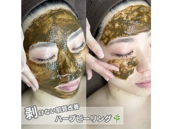 イース(ease)/剥けないハーブピーリング