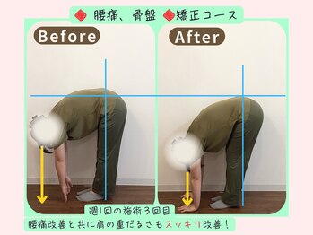 リフィール 国分寺店/Before&After【骨盤/姿勢/整体】