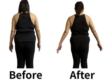 asmot鍼灸 整体院 代々木上原(asmot鍼灸 整体院)/【代々木上原】 鍼灸ダイエット