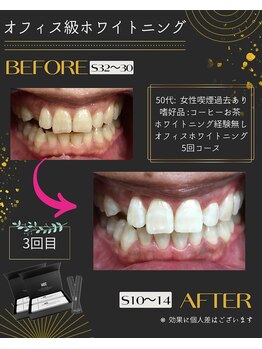 ホワイトニングプラス(Whitening+)/効果がメキメキと!!