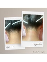 ブラジリアンワキシング シックスナイン(BrazilianWaxing69)/女性 / うなじ