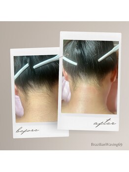 ブラジリアンワキシング シックスナイン(BrazilianWaxing69)/女性 / うなじ