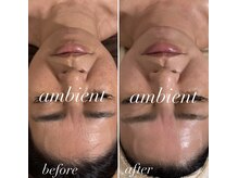 アンビエント(ambient)の雰囲気（100%天然ハーブで本物の肌質改善をあなたに。グリーンピール）