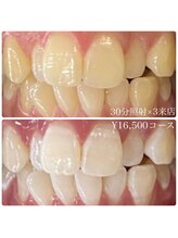 ホワイトニングルーム 横浜店(Whitening Room)/セルフホワイトニング/横浜