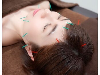 ブルースター/美容鍼