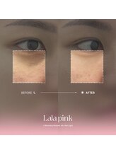 カルム(Calme)/Lalapink