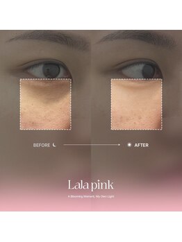 カルム(Calme)/Lalapink