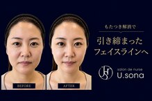 サロン ド ナース ユー ソナ(salon de nurse U.sona)
