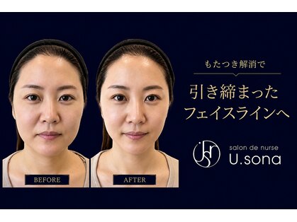 サロン ド ナース ユー ソナ(salon de nurse U.sona)の写真