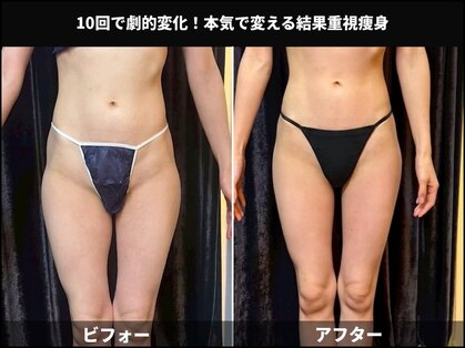アスエ(ASUE)の写真