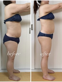 バニスティ 鶴岡店/あし長とヒップアップ