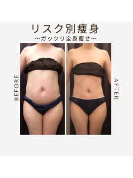エステサロン 美飾り イオンモール木更津店/before⇒after/全身痩せ
