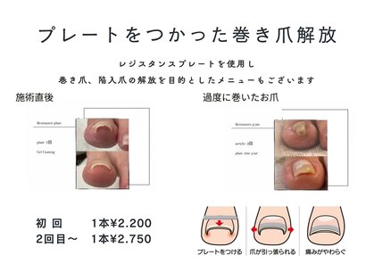 ネイルベース ネイル ケア サロン ミウラ(miura)の写真