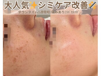 ベルファーム(Belle Femme)