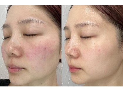 アンシャンテ 芦屋店の写真