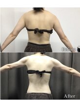 フィッツ 多治見店(fit's)/健康エステ