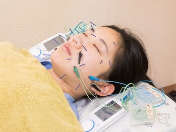 いなほ はりきゅう整骨院 東新宿の写真/≪延べ8.5万人以上の実績!院長施術≫老け顔改善・エイジングケアはコレ!リフトアップ美容鍼/初回¥7000