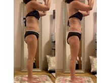 ローズクレール(Rose clair)の雰囲気（40代 モニター様  120分コース/1回　※結果には個人差あり）