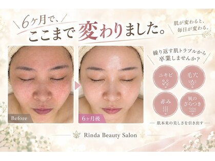 リンダ(Rinda)の写真