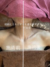 ジュエイル(JUEIRU)/経絡オイルリンパの効果