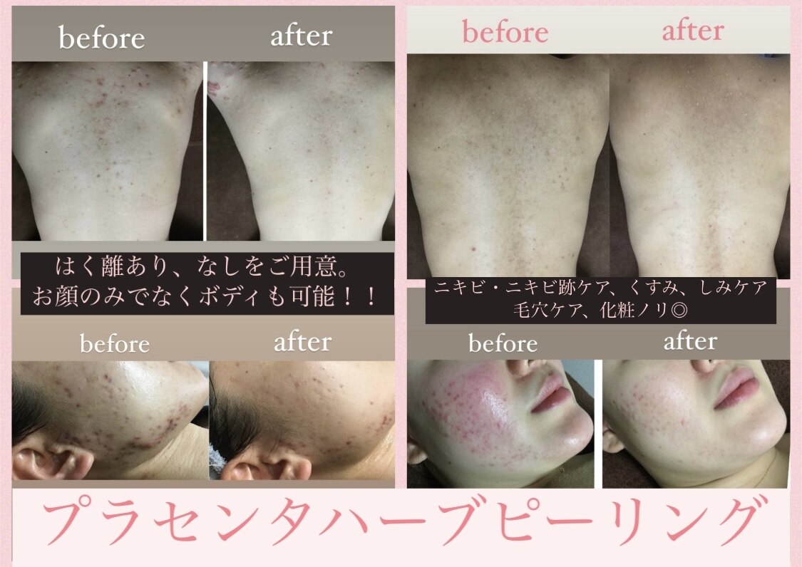 ビークレアーズ ビビ(B-crears. ViVi)｜ホットペッパービューティー