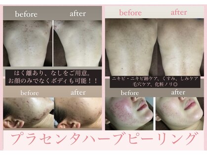 ビークレアーズ ビビ(B-crears. ViVi)の写真