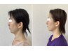 【美容小顔No.1♪】小顔×骨盤矯正で体も顔もシャープに☆8,800円→5,500円